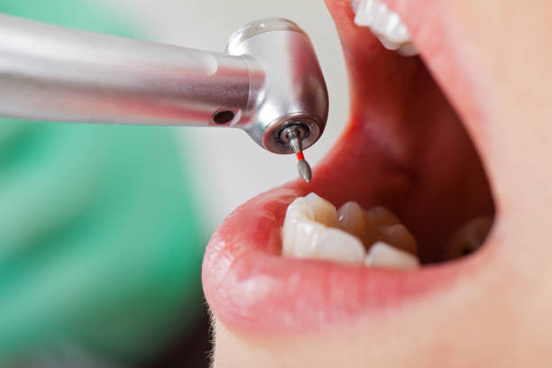 Best Cracked Tooth Emergency Dentist  in Pink, OK
